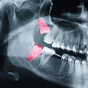 Miramar Beach Oral Surgery Office